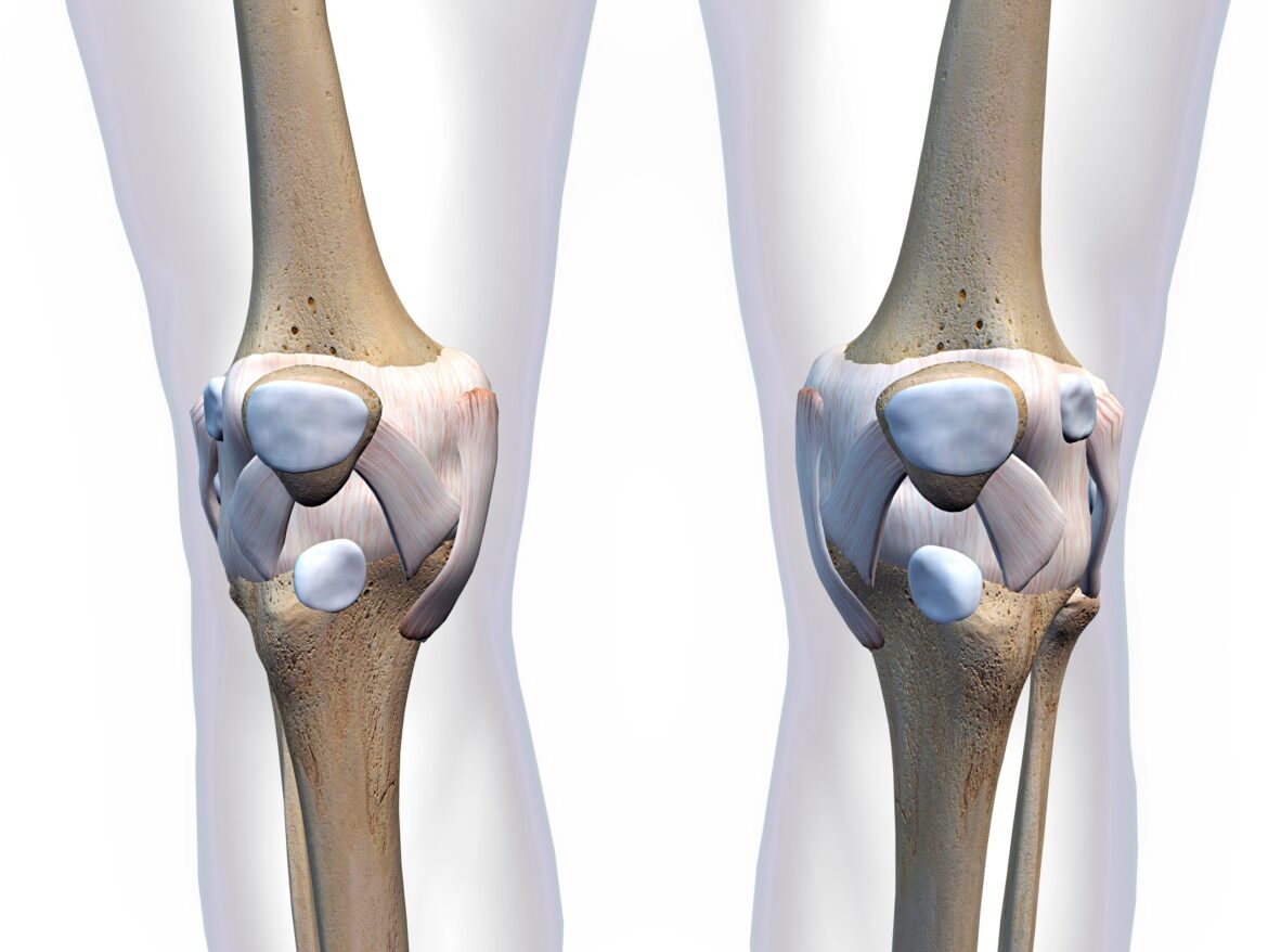 What Are The Best Knee Pain Treatment Options Available In Manhattan?